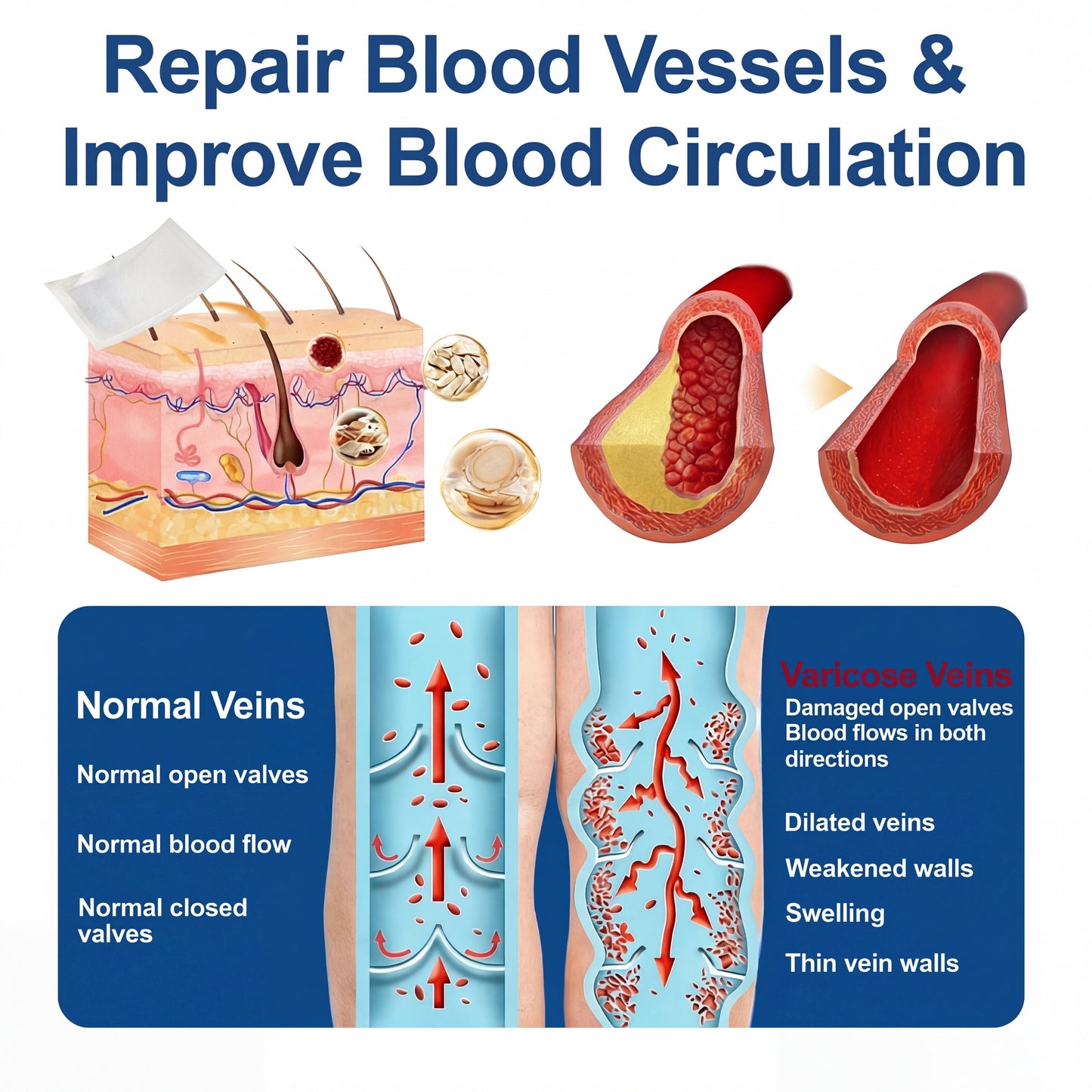 🇺🇸CareUplift® VeinTarget 🦵 Microneedle Patch – Relieves Leg Swelling & Varicose/Spider Veins ✅